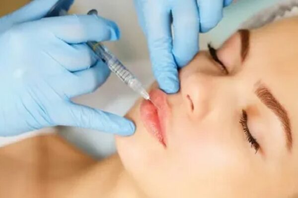Lip Fillers in Riyadh: The Ultimate Guide to Plumper Lips Lip Fillers Injections in Riyadh