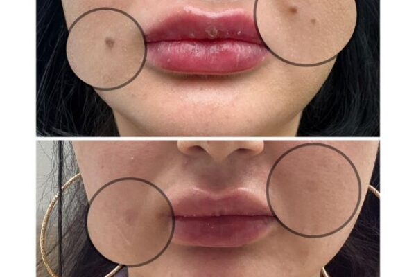 Discover Radiant Skin at Richmond Skin Clinic Your Ultimate Guide to Modern Skincare richmond skin clinic