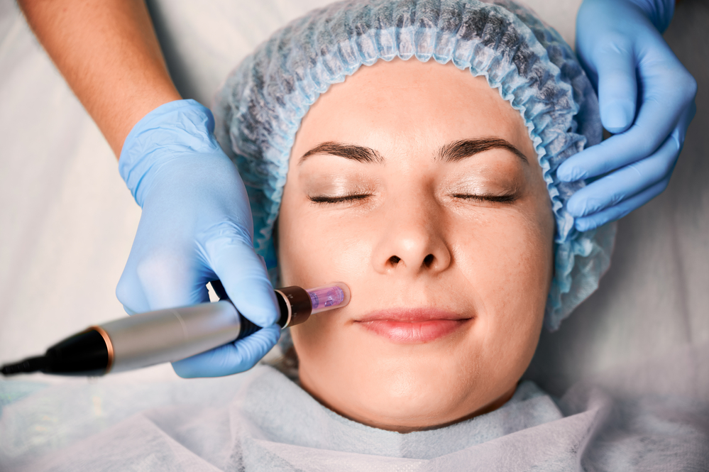 7D Hifu facial treatment