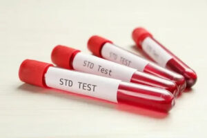 STD Test in Dubai
